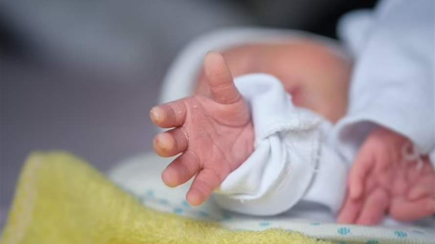 وفاة طفل بعد ولادته مع وجهين و4 أذرع وأرجل... وصور تُظهر الحالة النادرة (صور)