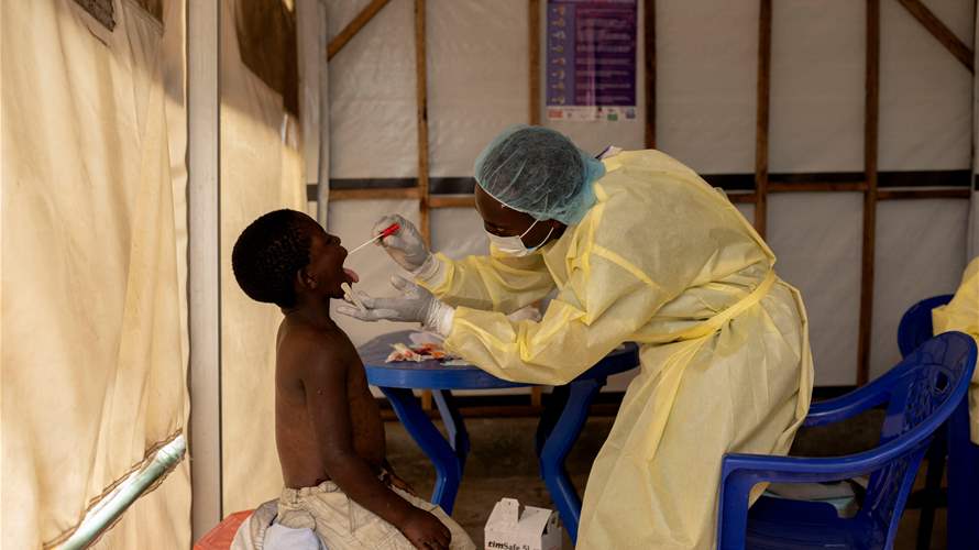 منظمة الصحة العالمية تريد عقد لجنة طوارئ في ظل انتشار فيروس "إم بوكس"